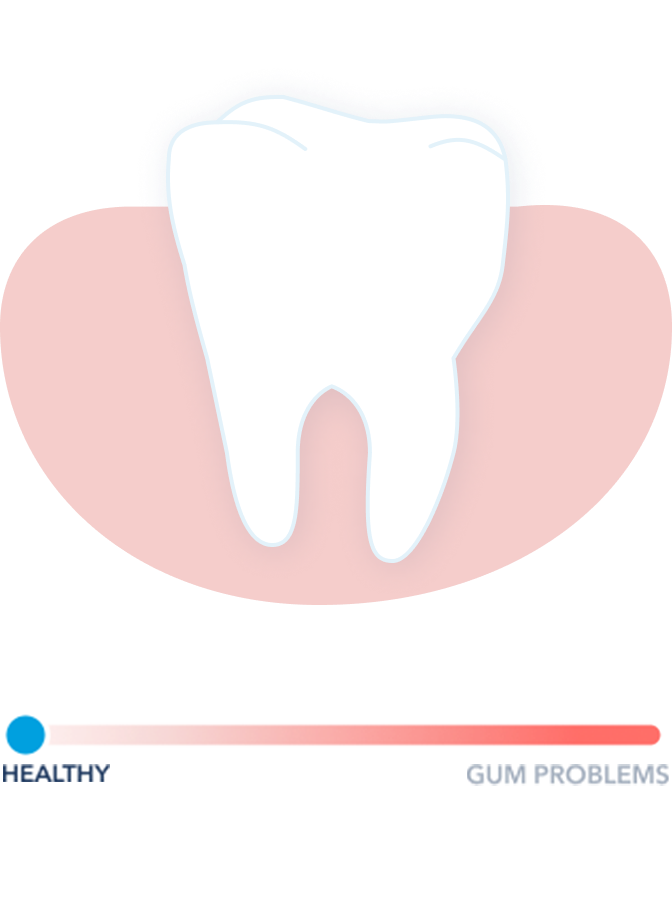 Healthy Gums