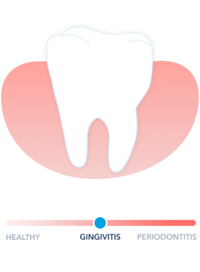 Healthy Gums
